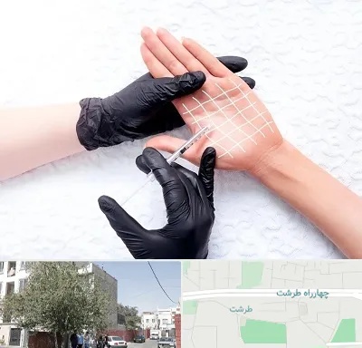 تزریق بوتاکس کف دست در طرشت