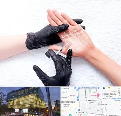 تزریق بوتاکس کف دست در جمهوری 