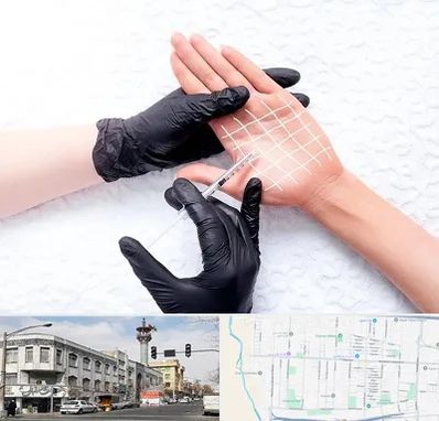 تزریق بوتاکس کف دست در 17شهریور