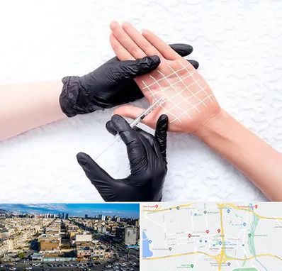 تزریق بوتاکس کف دست در شهرک راه آهن