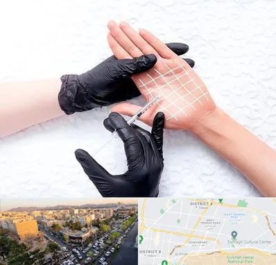 تزریق بوتاکس کف دست در تهرانپارس 