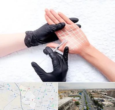 تزریق بوتاکس کف دست در حصارک کرج