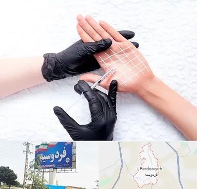 تزریق بوتاکس کف دست در فردوسیه شهریار