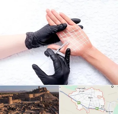تزریق بوتاکس کف دست در بم