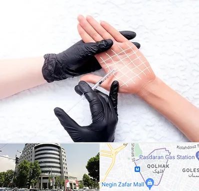 تزریق بوتاکس کف دست در قلهک 