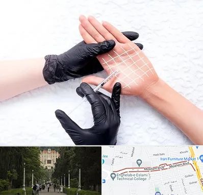 تزریق بوتاکس کف دست در بلوار معلم رشت 