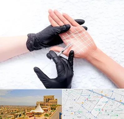 تزریق بوتاکس کف دست در هاشمیه مشهد