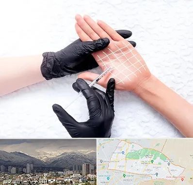 تزریق بوتاکس کف دست در منطقه 4 تهران 