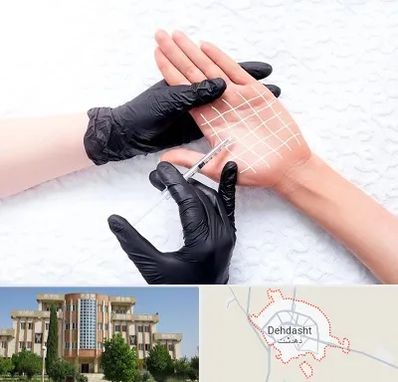 تزریق بوتاکس کف دست در دهدشت