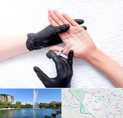 تزریق بوتاکس کف دست در کوهسنگی مشهد