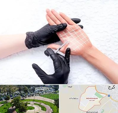 تزریق بوتاکس کف دست در مهرشهر کرج 