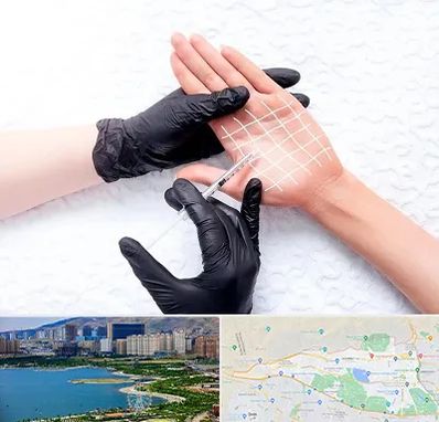 تزریق بوتاکس کف دست در منطقه 22 تهران 