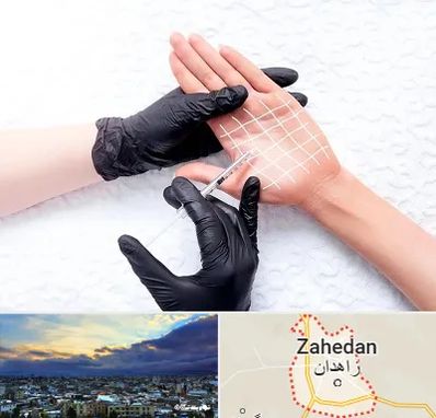 تزریق بوتاکس کف دست در زاهدان