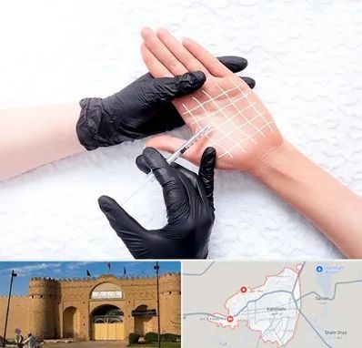 تزریق بوتاکس کف دست در ایرانشهر