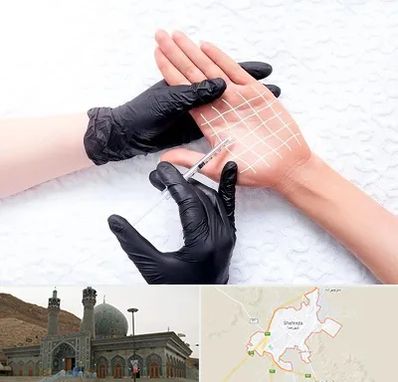 تزریق بوتاکس کف دست در شهرضا