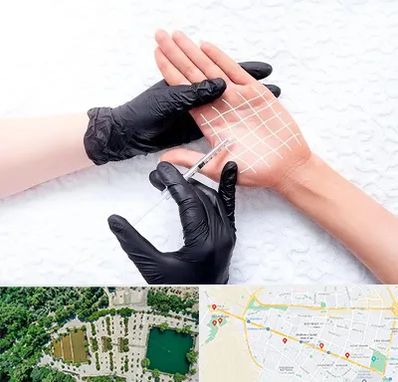 تزریق بوتاکس کف دست در وکیل آباد مشهد