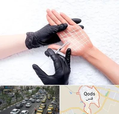 تزریق بوتاکس کف دست در شهر قدس