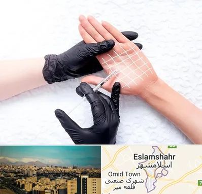 تزریق بوتاکس کف دست در اسلامشهر