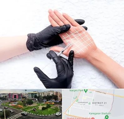 تزریق بوتاکس کف دست در تهرانسر 