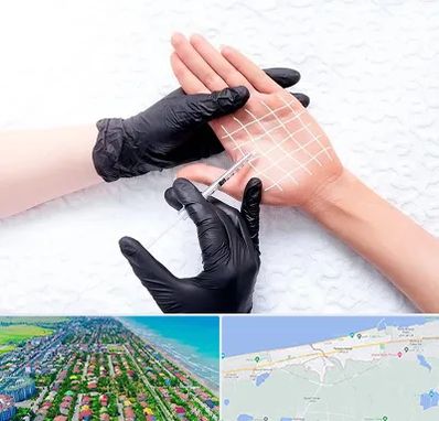 تزریق بوتاکس کف دست در فریدونکنار