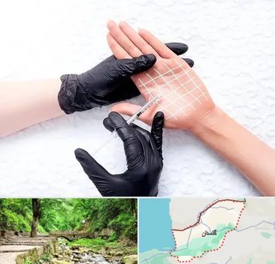 تزریق بوتاکس کف دست در گلستان