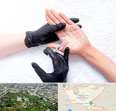 تزریق بوتاکس کف دست در شهرکرد