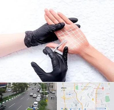 تزریق بوتاکس کف دست در ستارخان 