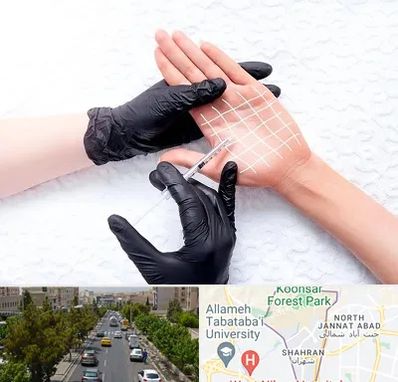 تزریق بوتاکس کف دست در شهران 