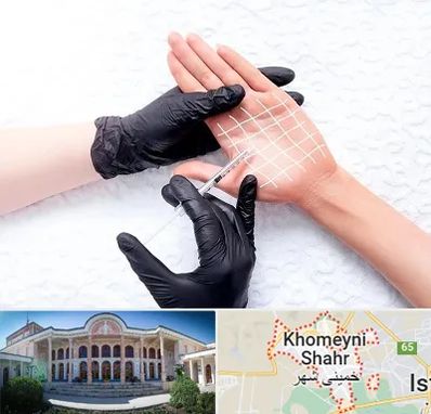 تزریق بوتاکس کف دست در خمینی شهر