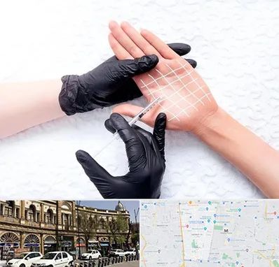 تزریق بوتاکس کف دست در منطقه 11 تهران 