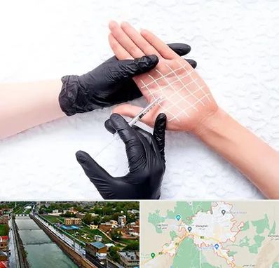 تزریق بوتاکس کف دست در مراغه