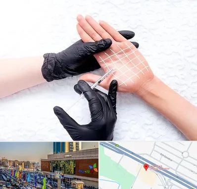 تزریق بوتاکس کف دست در لاله پارک تبریز