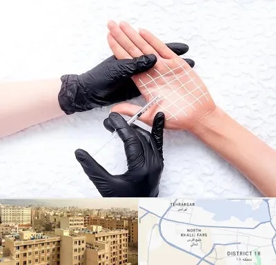 تزریق بوتاکس کف دست در جنوب غرب تهران