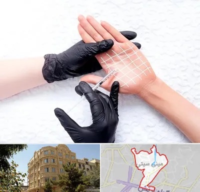 تزریق بوتاکس کف دست در مینی سیتی