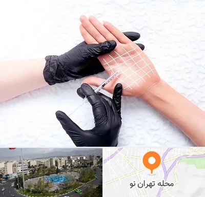 تزریق بوتاکس کف دست در تهران نو