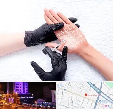 تزریق بوتاکس کف دست در آبرسان تبریز