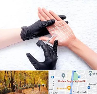 تزریق بوتاکس کف دست در چهارباغ اصفهان