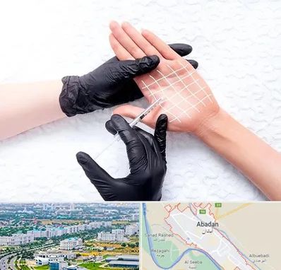 تزریق بوتاکس کف دست در آبادان