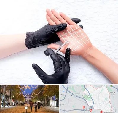 تزریق بوتاکس کف دست در ولیعصر ارومیه