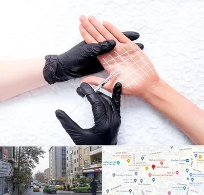 تزریق بوتاکس کف دست در فاطمی 