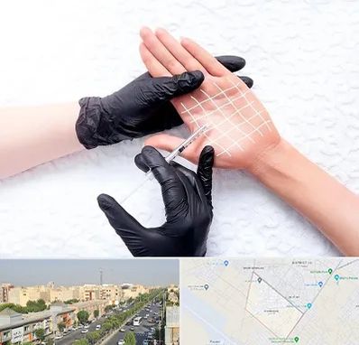 تزریق بوتاکس کف دست در کیانمهر کرج