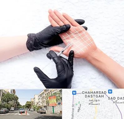 تزریق بوتاکس کف دست در چهارصد دستگاه 