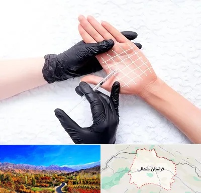 تزریق بوتاکس کف دست در خراسان شمالی