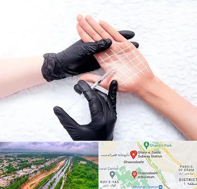 تزریق بوتاکس کف دست در قصرالدشت شیراز