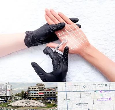 تزریق بوتاکس کف دست در مرکز تهران