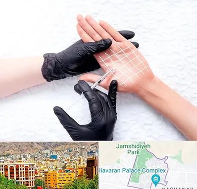 تزریق بوتاکس کف دست در نیاوران 