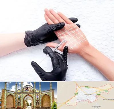 تزریق بوتاکس کف دست در سمنان