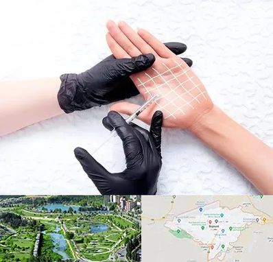 تزریق بوتاکس کف دست در بجنورد
