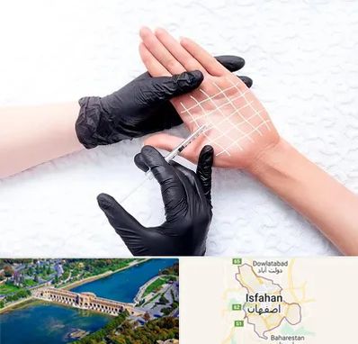 تزریق بوتاکس کف دست در اصفهان