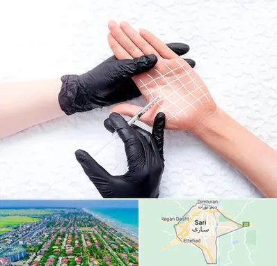 تزریق بوتاکس کف دست در ساری